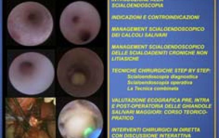 SCIALOENDOSCOPIA DIAGNOSTICA E OPERATIVA